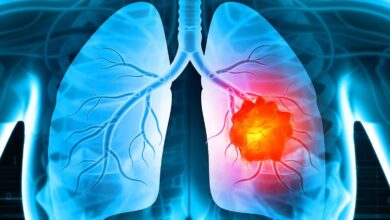 How to Identify the Best Cancer Hospital for Long-Term Treatment