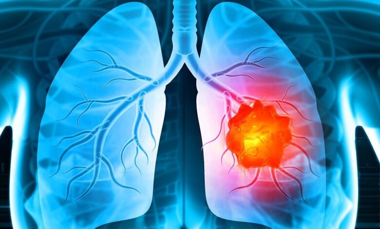 How to Identify the Best Cancer Hospital for Long-Term Treatment